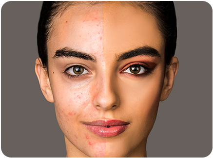 Woman with and without brown spots on her face