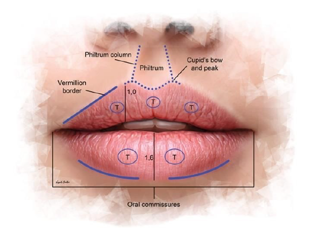 Diagram of lips: upper and lower lips, philtrum, cupid's bow, vermillion border, corners of the mouth.